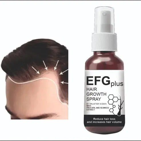 Hair Growth Spray â€“ 50ml (Pack of 2)